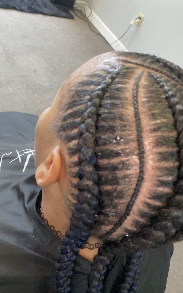 Krystal Klear - hair transplant in Memphis, TN