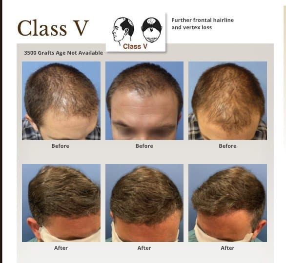 Meshkin Medical - hair transplant in Glendale, CA