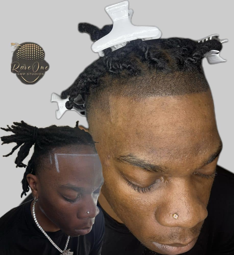 Rare0ne Smp Studios - hair transplant in San Antonio, TX