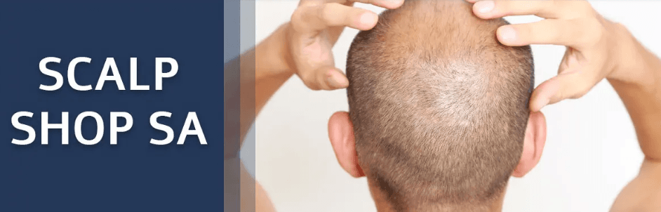 Scalp Shop - hair transplant in San Antonio, TX