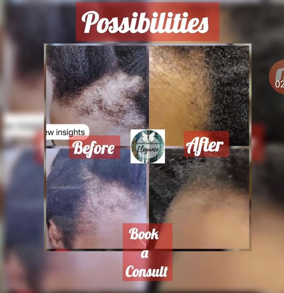 Crochet And MicroLoc Elegance - hair transplant in Charlotte, NC