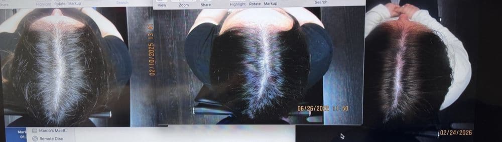 HairWise - hair transplant in Miami, FL