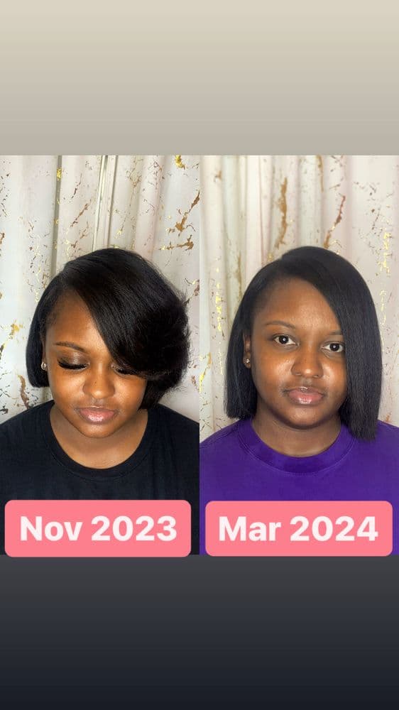 Quelity Styles - hair transplant in Germantown, TN