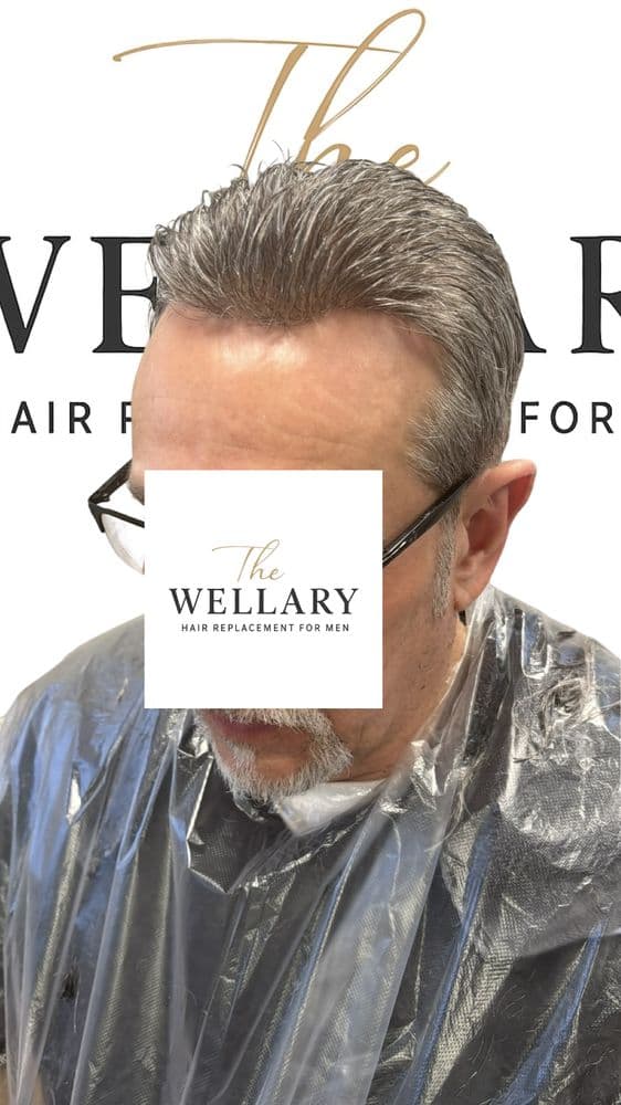 The Wellary Hair Replacement for Men - hair transplant in Concordville, PA