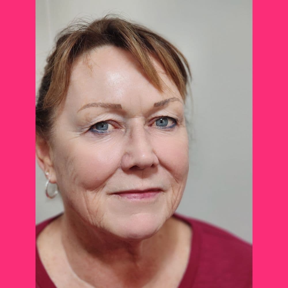 iBrow Vixen - hair transplant in San Francisco, CA