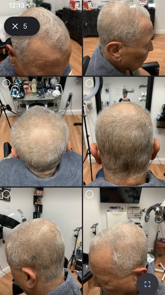 Trichology By Dahleen & PMU - hair transplant in Winter Springs, FL