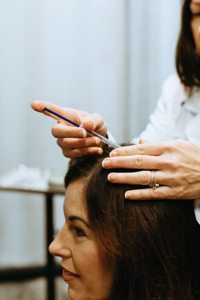 Holly Strack - hair transplant in Edina, MN