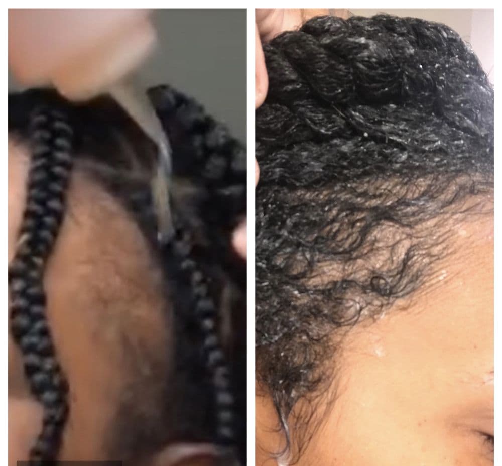 Curlaholicss - hair transplant in Tulsa, OK