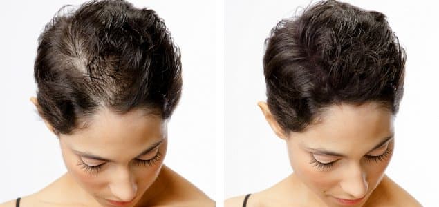 Mp Scalp Hair Studio - hair transplant in Tampa, FL