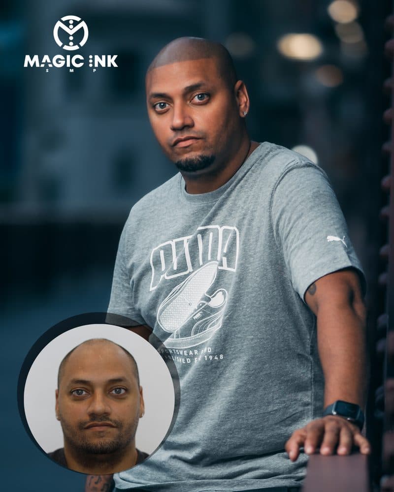 Magic Ink SMP - hair transplant in Winnetka, IL