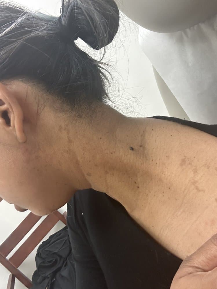 Berman Skin Institute - hair transplant in Roseville, CA