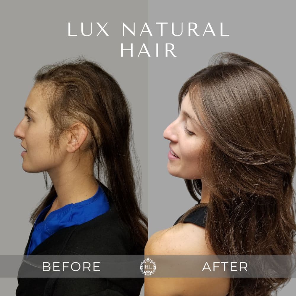 Hairlab Chicago - hair transplant in Deerfield, IL