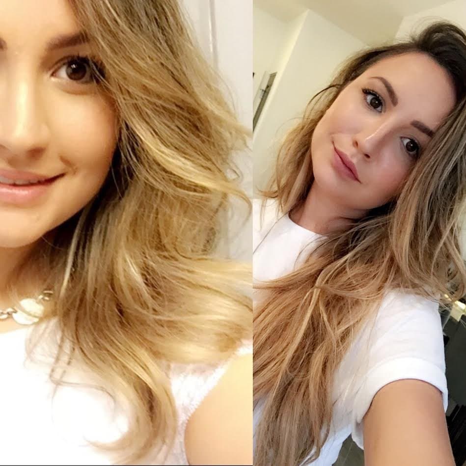 Nina Ross Hair Therapy - hair transplant in Atlanta, GA