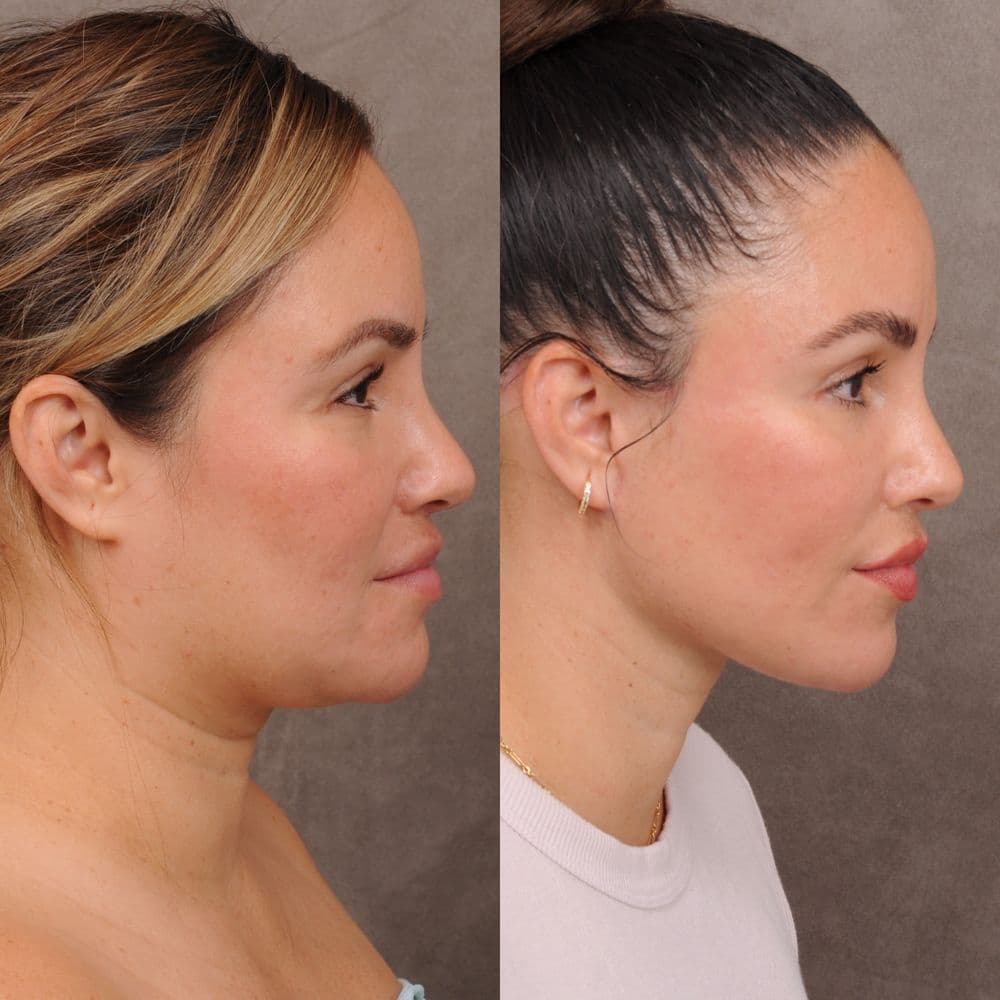 Ben Talei, MD - hair transplant in Beverly Hills, CA