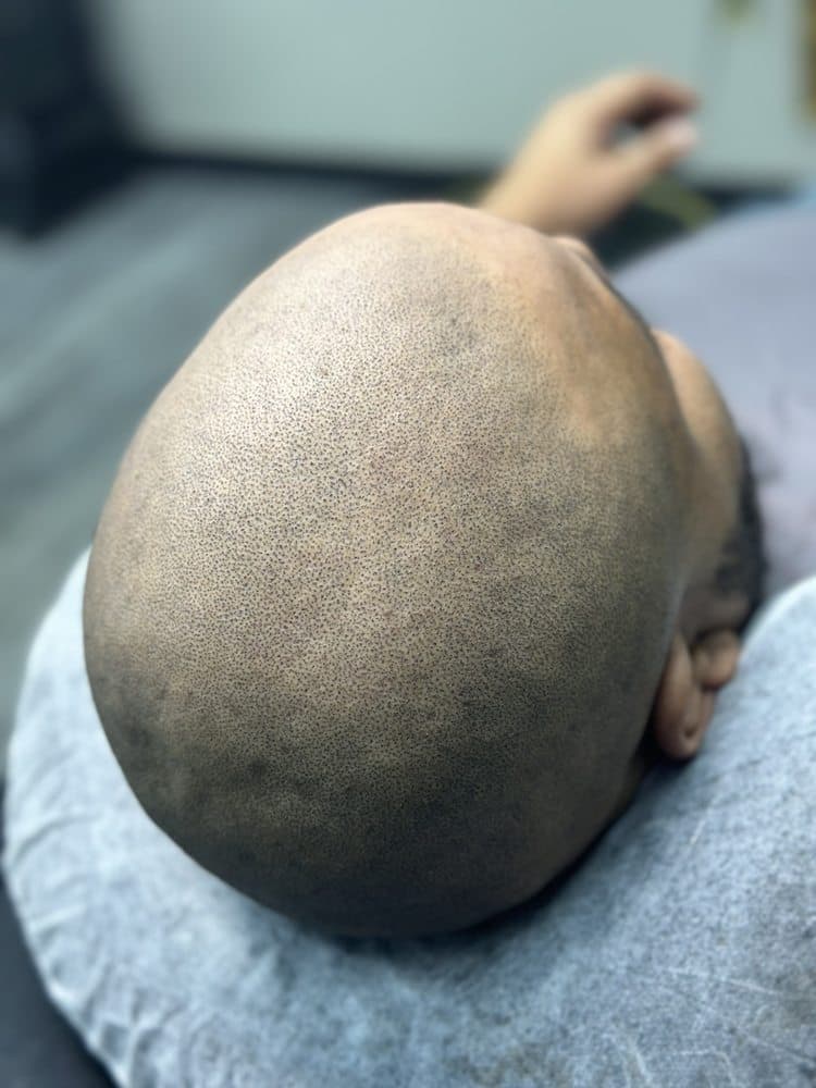 Vivid Cosmetic Studio - hair transplant in Memphis , TN