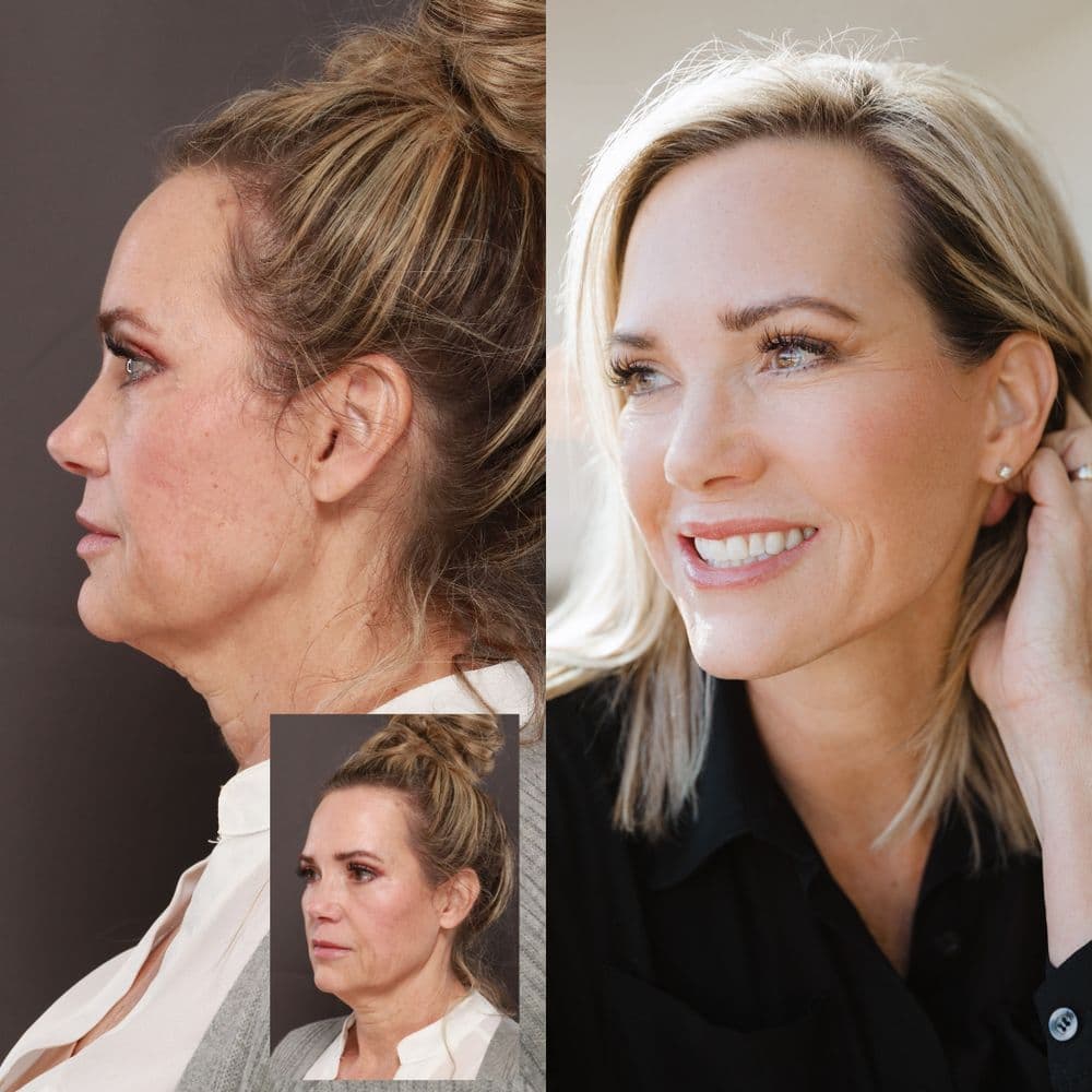 Utah Facial Plastics - hair transplant in Layton, UT