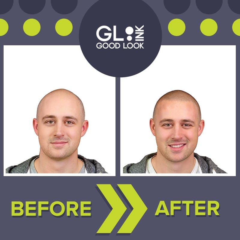 Good Look Ink - hair transplant in Houston, TX