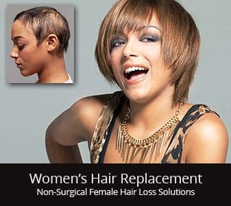 Invisions of Connecticut - hair transplant in Middlebury, CT