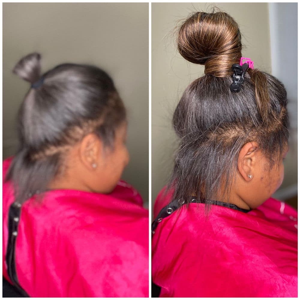 The Jae Way Experience - hair transplant in Southfield, MI