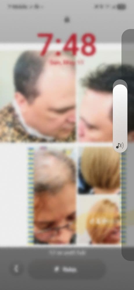 Lucy Vargas Hair Replacement Center - hair transplant in Kissimmee, FL