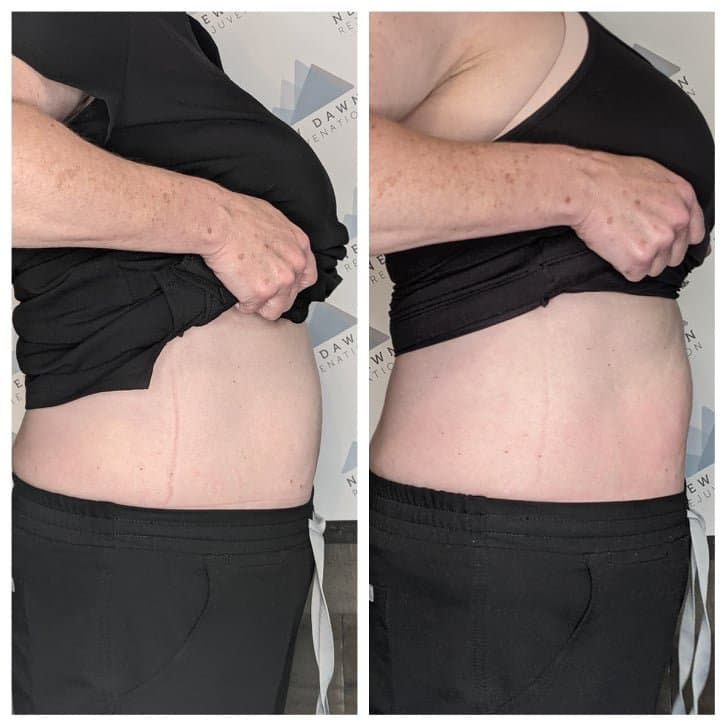 New Dawn Rejuvenation - hair transplant in Lakeway, TX