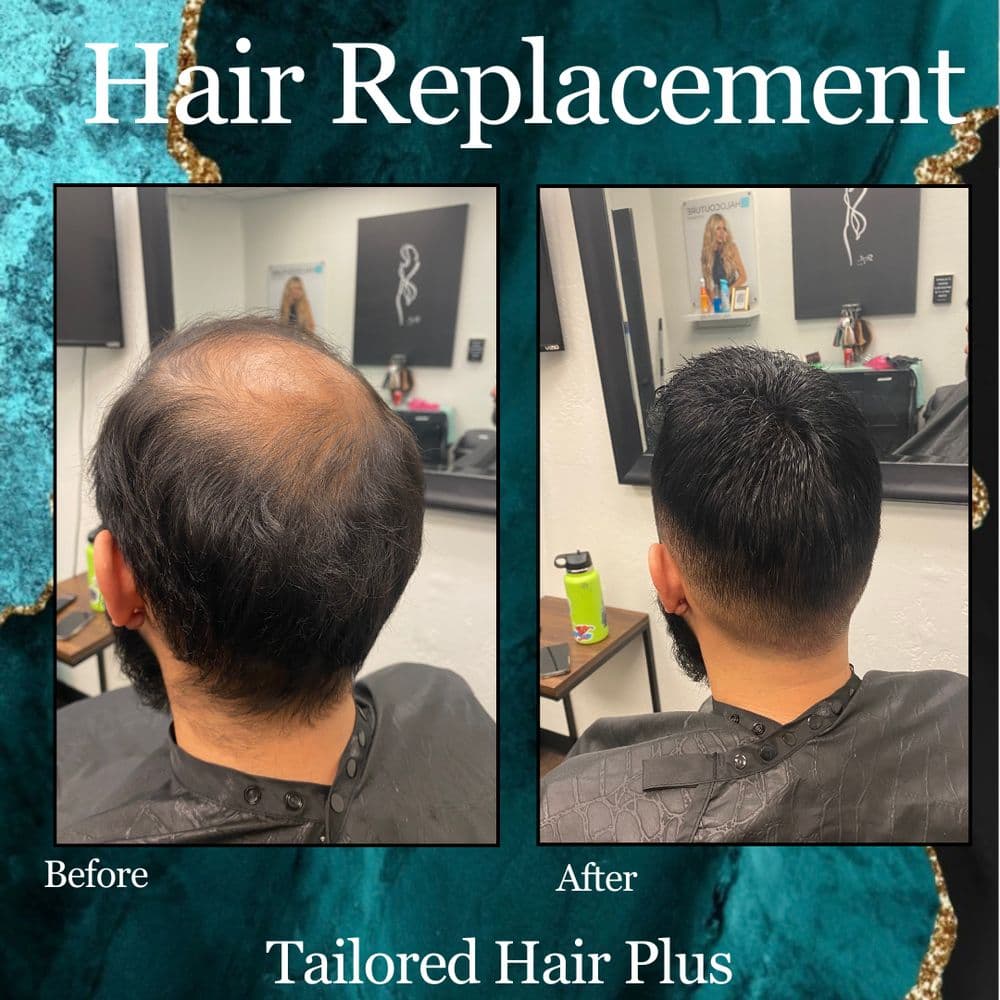 Tailored Hair Plus - hair transplant in Phoenix, AZ