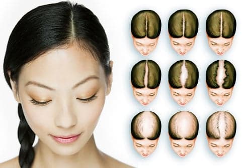 Pizarro Hair Restoration - hair transplant in Orlando, FL