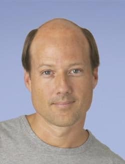 Mr & Ms Executive - hair transplant in Des Moines, IA