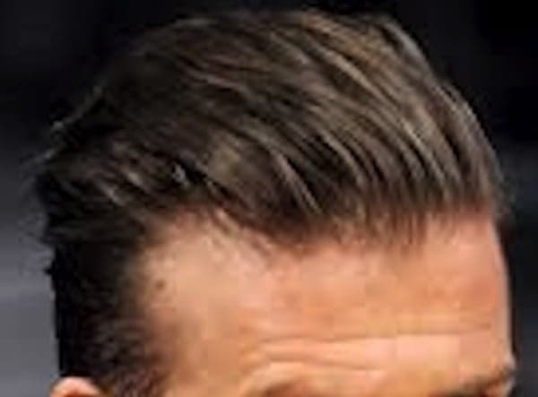 Joseph's Hair Center - hair transplant in Monterey Park, CA