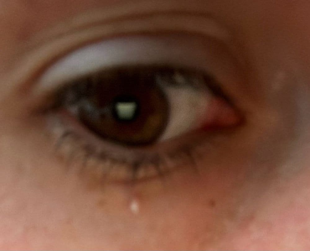 Magnolia Dermatology - hair transplant in Jackson, MS