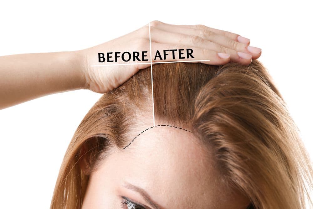 Charming Skin Vein Clinics - hair transplant in Oak Brook, IL