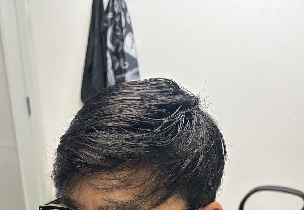 Keep Austin hair - hair transplant in Austin, TX