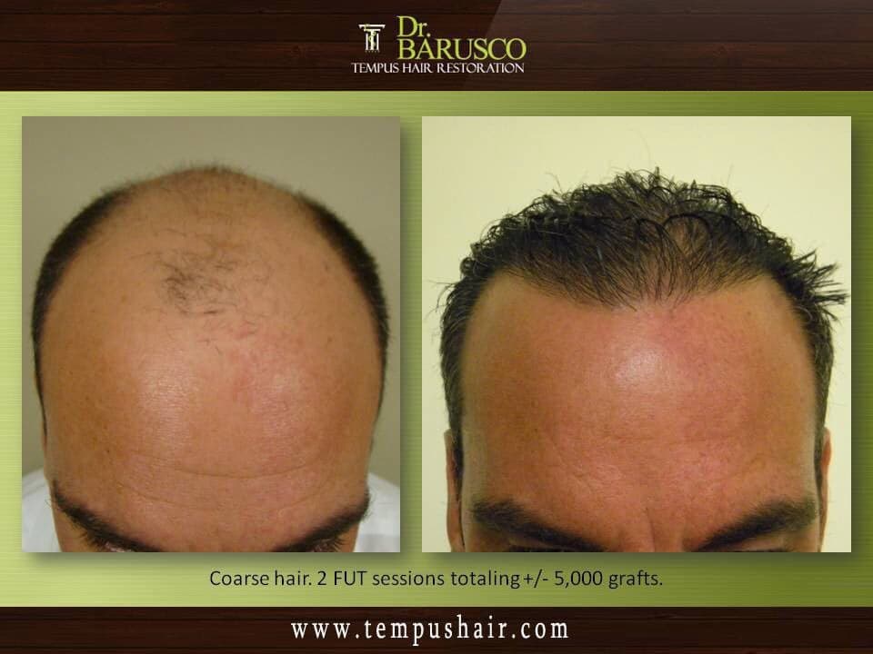 Tempus Hair Restoration - hair transplant in Ponte Vedra Beach, FL
