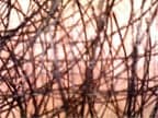 Anagen Hair Clinic - hair transplant in Tampa, FL