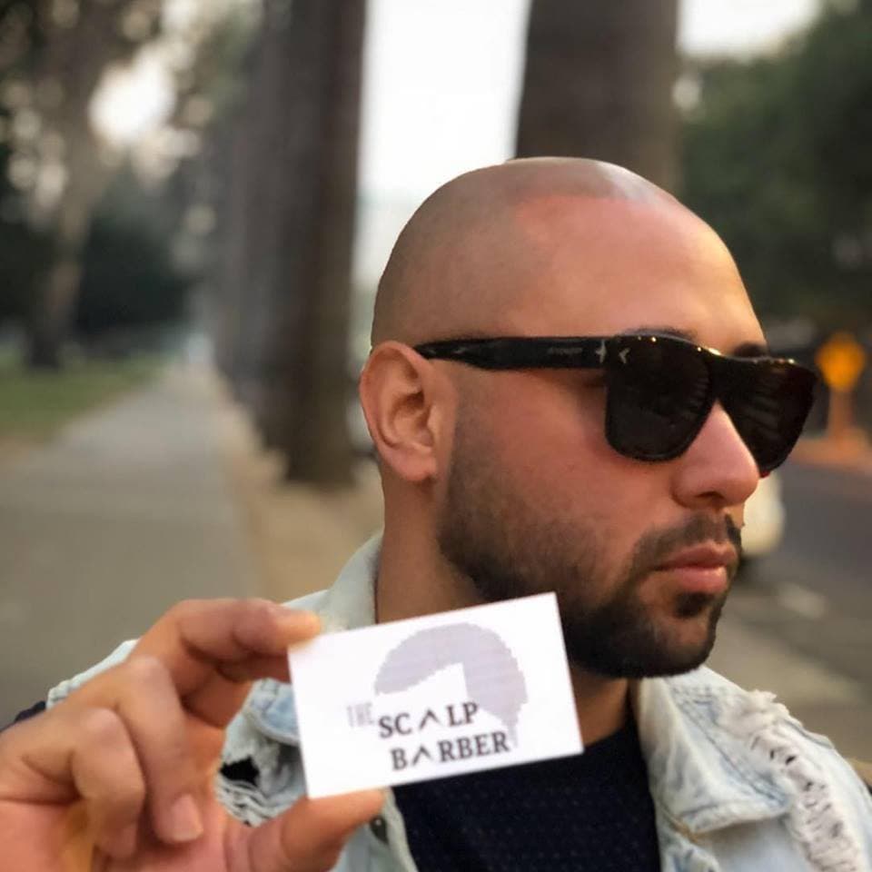 The Scalp Barber Scalp Micropigmentation by Allure - hair transplant in Sacramento, CA