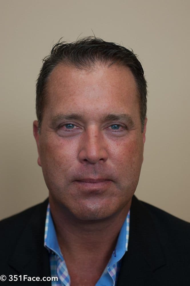 Advanced Hair Renewal Cntr - hair transplant in Cincinnati, OH