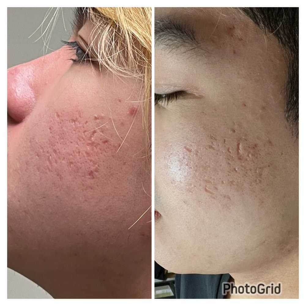 Beauty Koncept - hair transplant in San Francisco , CA
