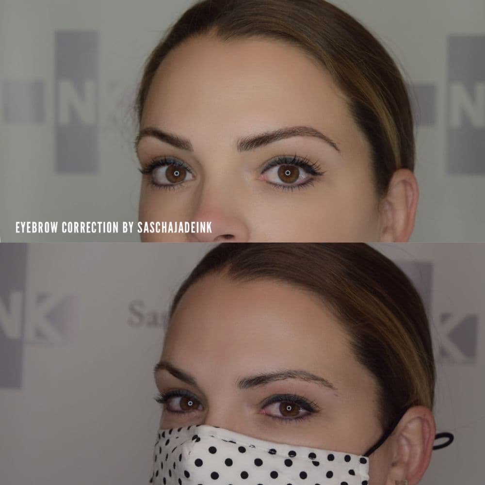 Sascha Jade Ink - hair transplant in Oklahoma City, OK