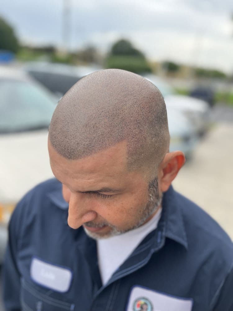 Ink Flow SMP - hair transplant in Kissimmee, FL