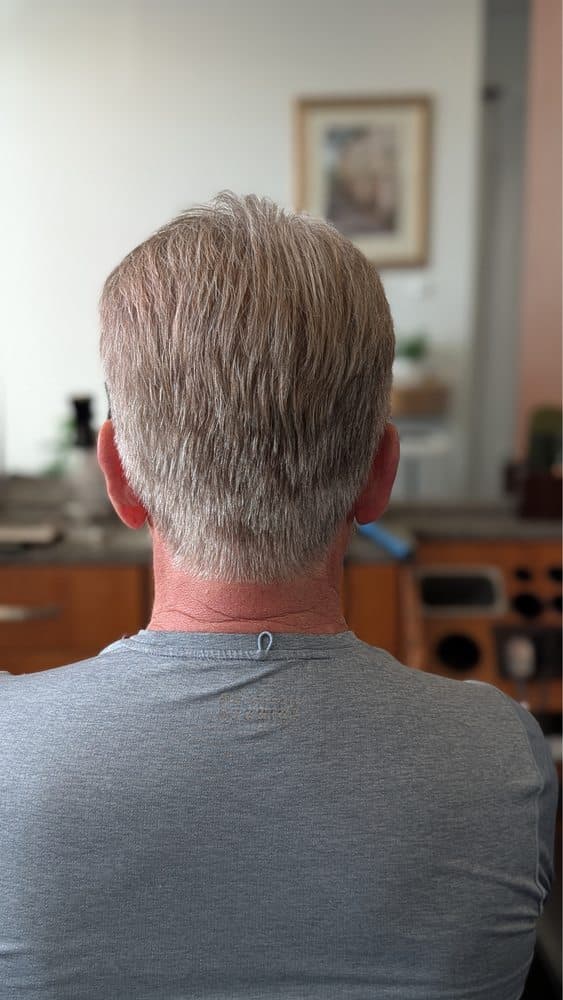 Jing Zhou Salon - hair transplant in San Mateo, CA