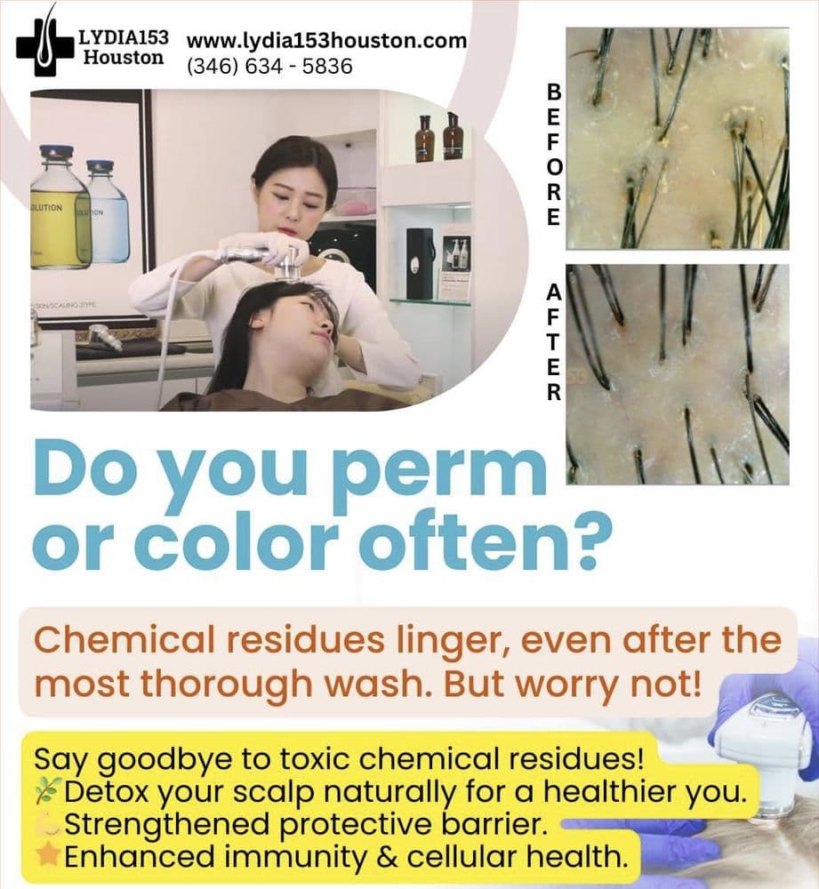 Lydia153 Houston Anti-aging Scalp Care - hair transplant in Houston, TX