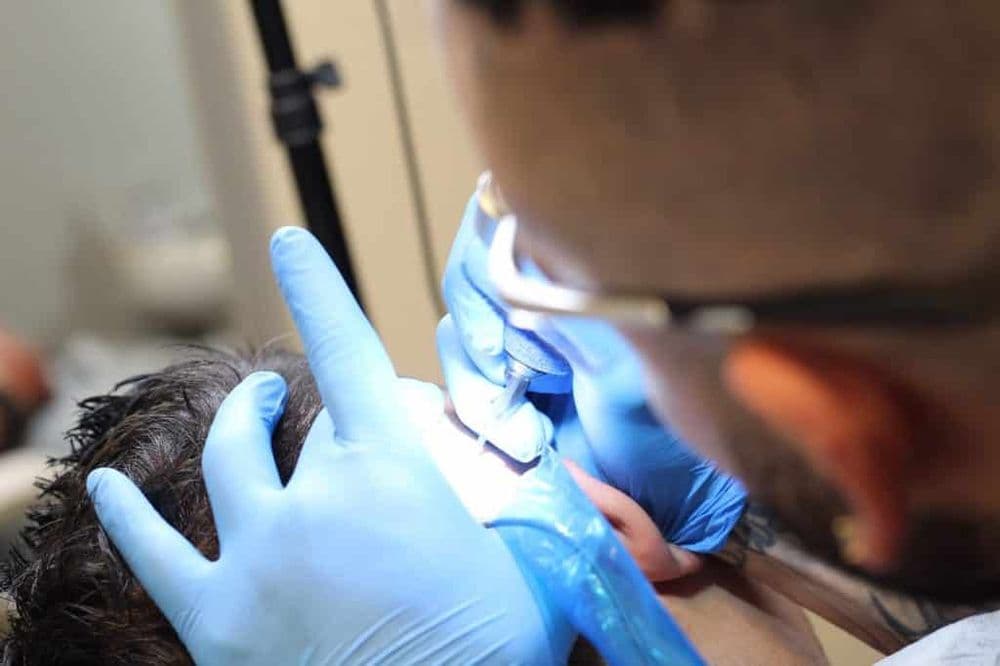 Masterpiece SMP Clinic - hair transplant in Scottsdale, AZ