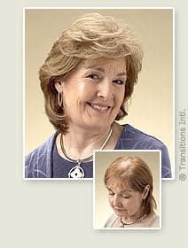 Crucial Hair Care - hair transplant in Spring, TX