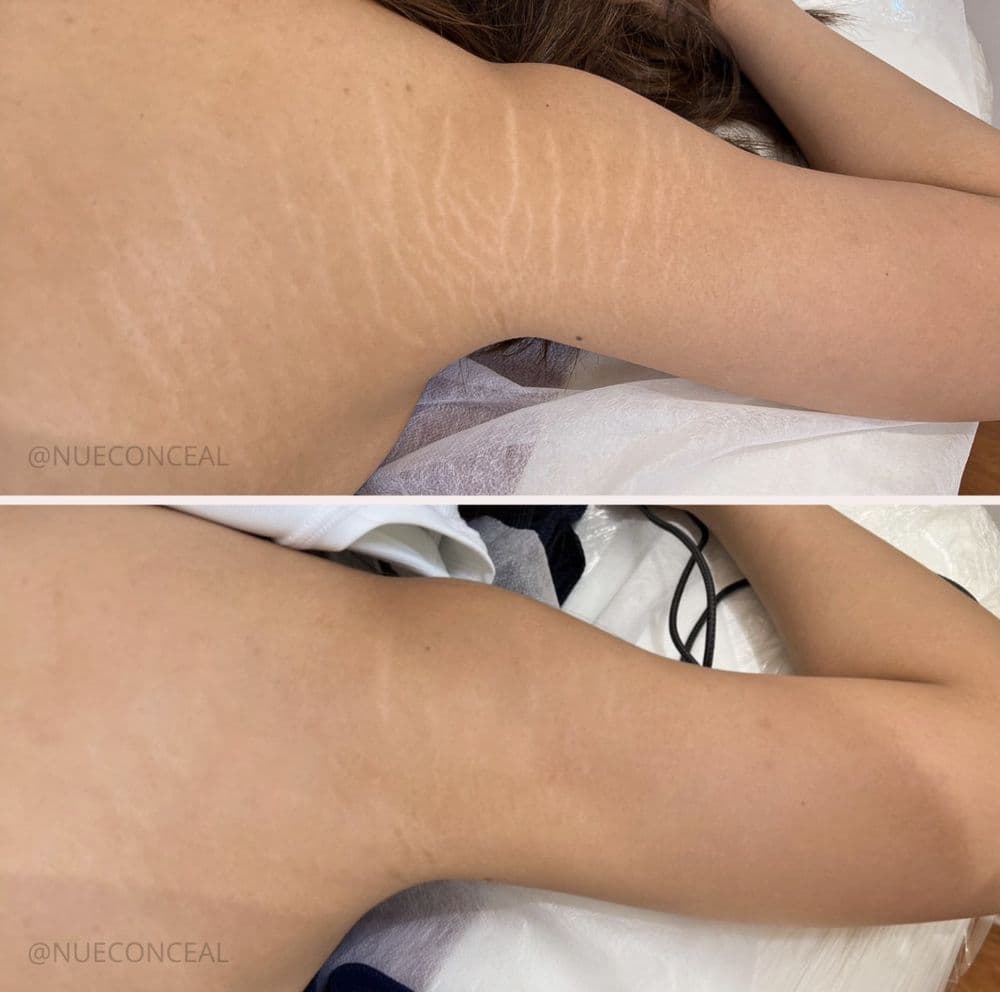 Fawnskin Studios - hair transplant in Carlsbad, CA
