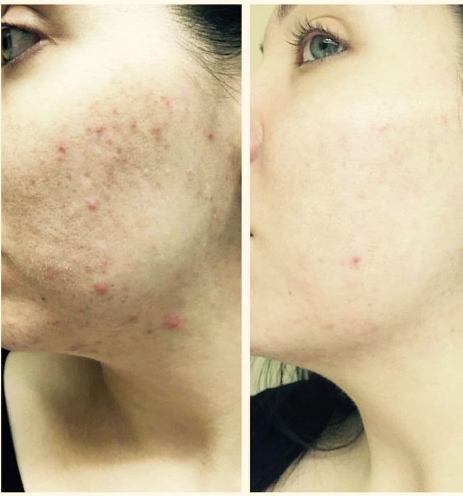 La Bella Vita Medi Spa - hair transplant in Rocklin, CA