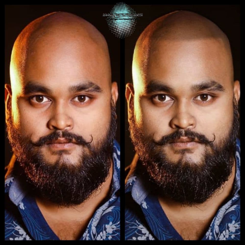 Impressions Scalp Micropigmentation - hair transplant in Williamsville, NY