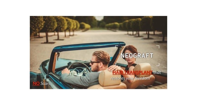 Buffalo Hair Transplant Center - hair transplant in Depew, NY