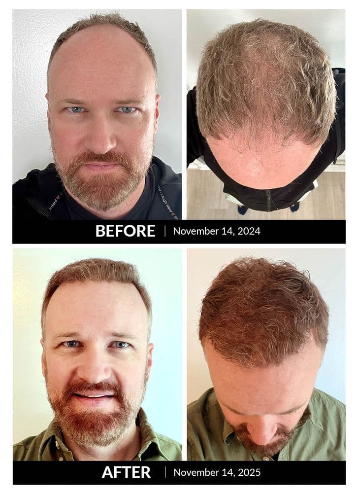 Flintridge Fue Hair Clinic & Wellness - hair transplant in Glendale, CA