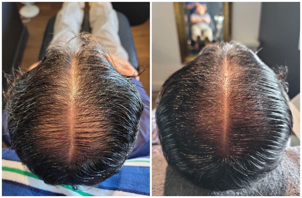 Damo Hair Loss Solution - hair transplant in Los Angeles, CA