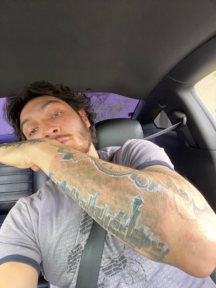 Bellamedica - hair transplant in Kirkland, WA